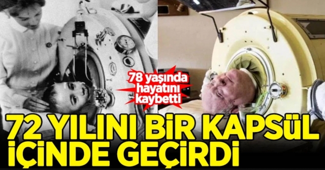 72 yılını bir kapsülde geçirdi! 78 yaşında hayatını kaybetti