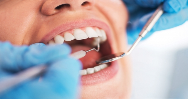 Ağız bakımı, koruyucu diş hekimliği ile desteklenmeli