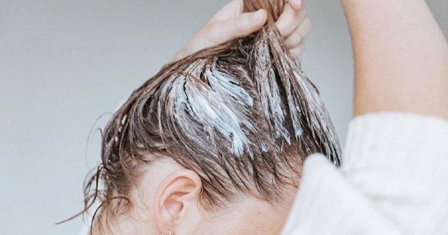 Çıkmayan saçların tedavisi! Hem doğal hem etkili tek tel dökülmeyecek!