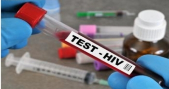 Avrupa HIV Test Farkındalığı Haftası Başladı