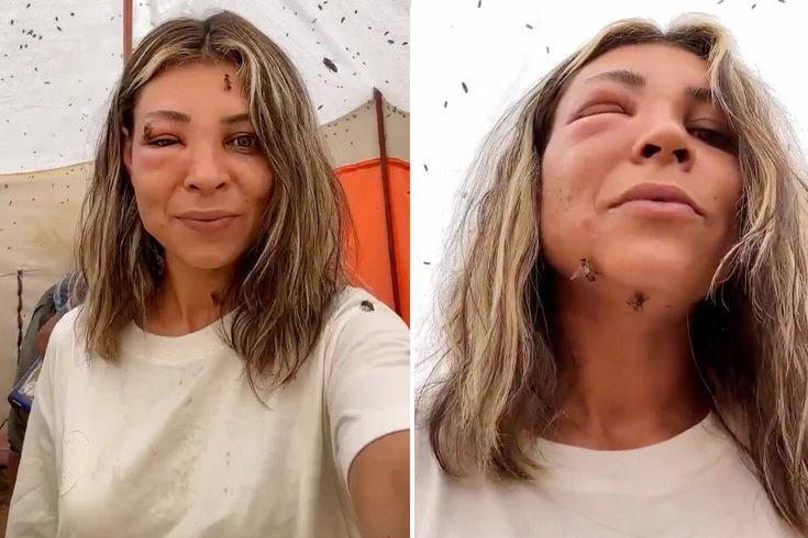 Yüzü Tanınmaz Hale Geldi